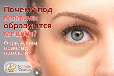 Мешки под глазами