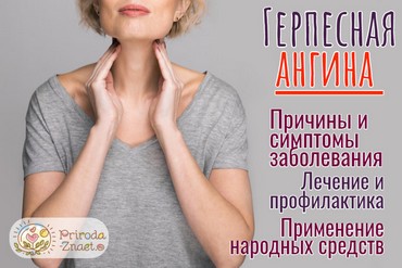 Ангина