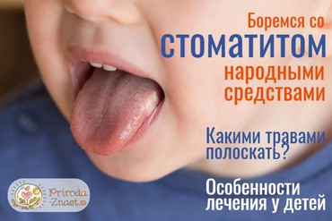 Стоматит лечение