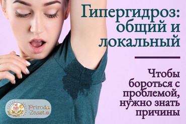 Причины потливости