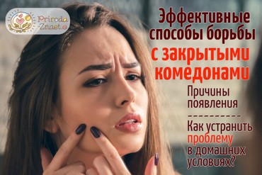Закрытые комедоны