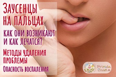 Заусеницы на пальцах